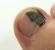 Болезни ногтей с изменением цвета Позеленел ноготь под нарощенным ногтем